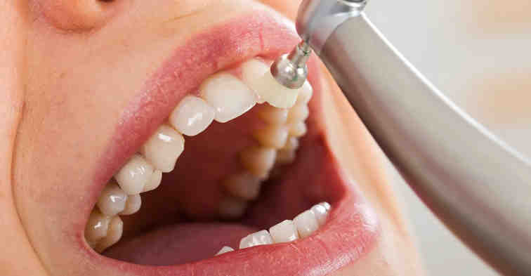 How much does cosmetic dental work cost?