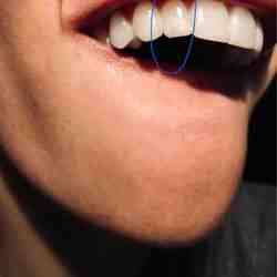 How much does cosmetic dental work cost?