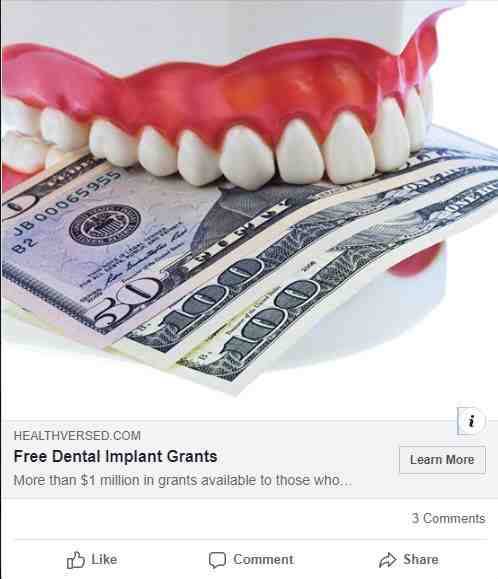 does-dental-insurance-pay-for-implants-dental-news-network