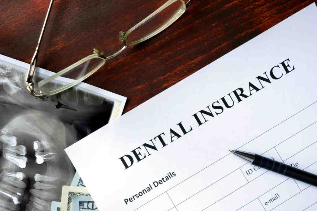 What dental insurance covers implants Dental News Network