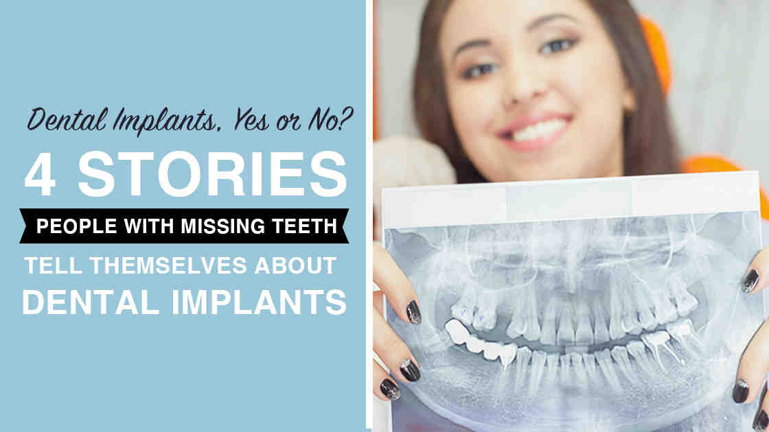 How much does it cost to pull all teeth and get implants?
