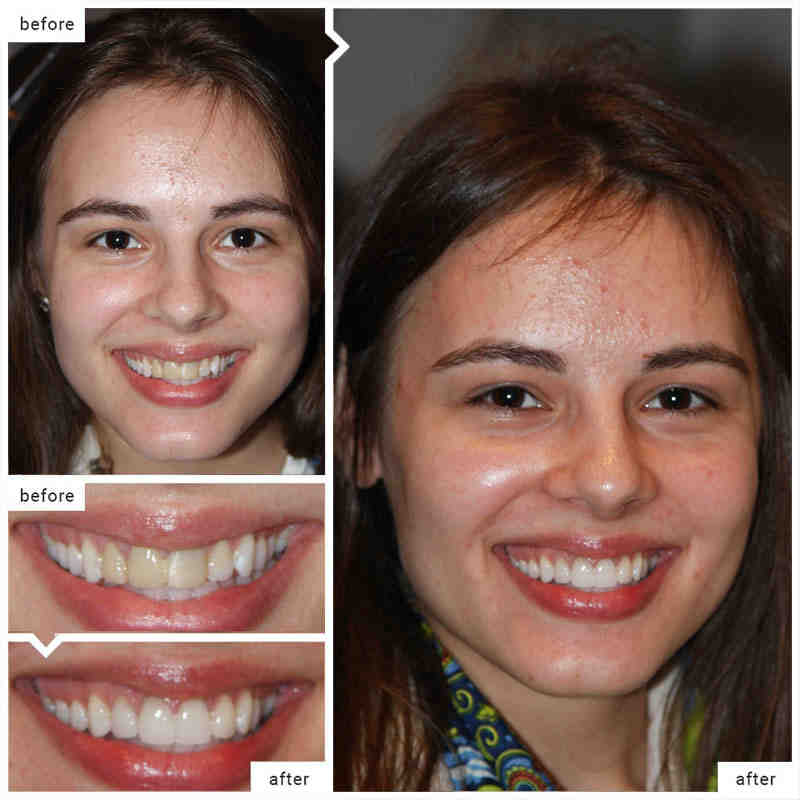 cosmetic-and-implant-dentistry-of-new-york-dental-news-network