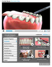 How much does it cost to veneer all your teeth?