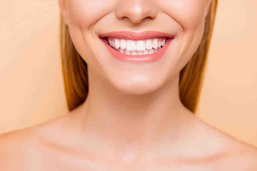 How much is a set of veneer teeth?