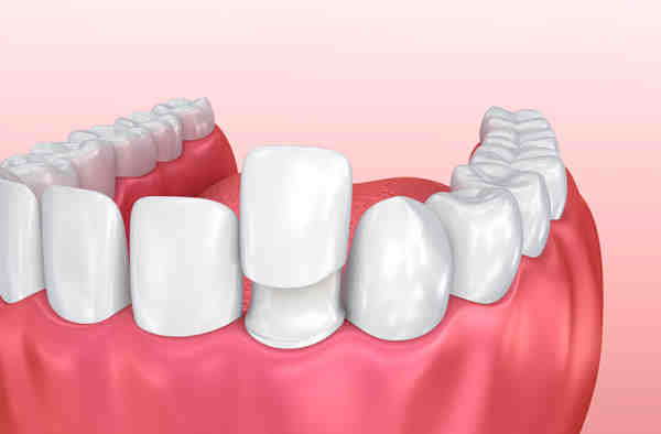 How much is cosmetic dentistry in South Africa?