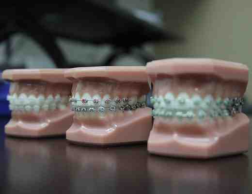 How much is cosmetic dentistry in South Africa?