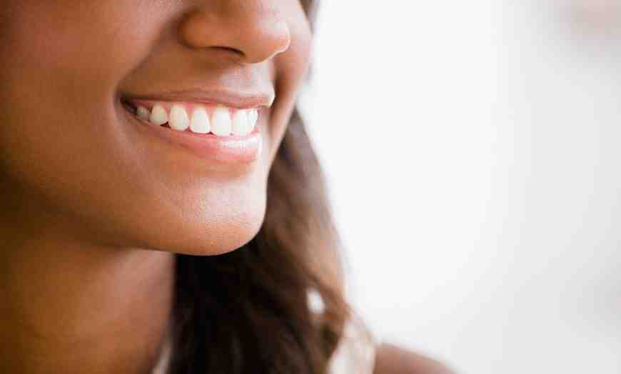 How much is cosmetic dentistry in South Africa?