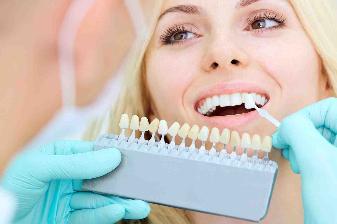 How much is cosmetic dentistry in South Africa?