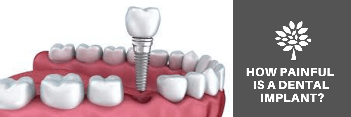 How painful is a dental implant?