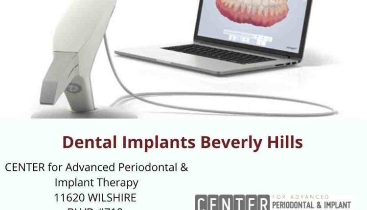 How to find a dental implant specialist