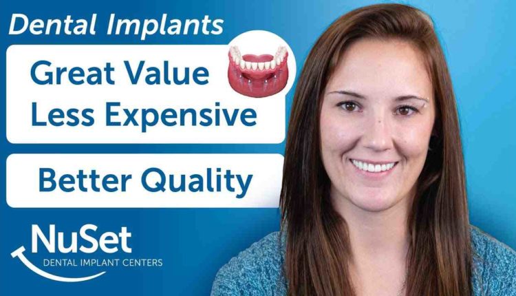 How to sell dental implants