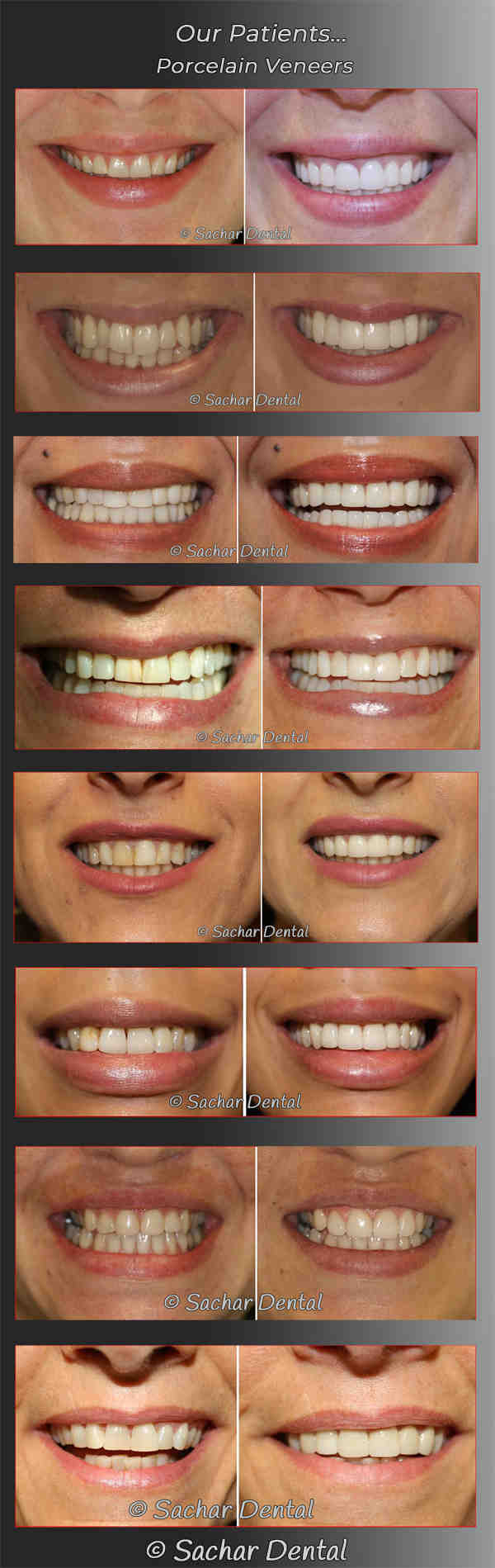 What are cosmetic dentistry procedures?