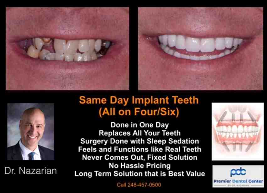 Are Permanent Dentures the Same as Implants?