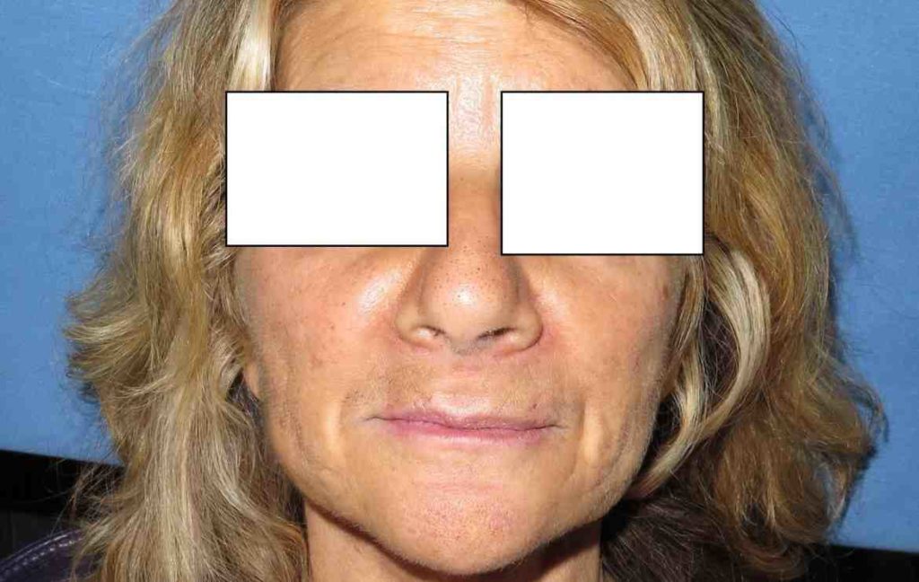 can-dental-implants-make-you-sick-dental-news-network