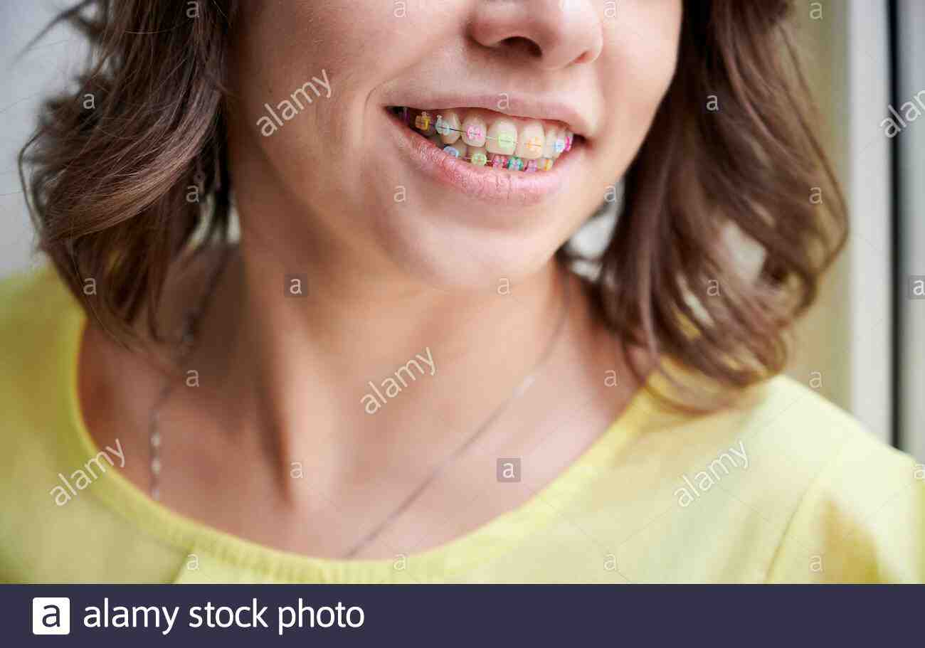 What does cosmetic dentistry include?