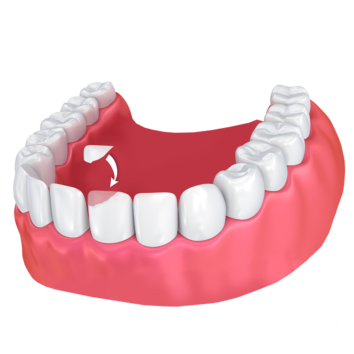 What does restorative dental treatment cover?