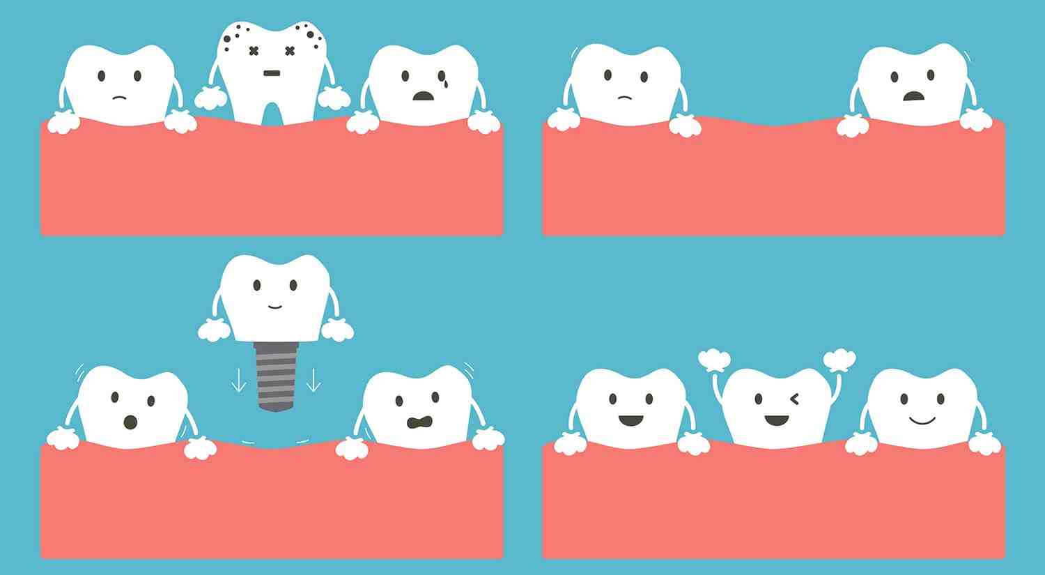 What is a reasonable price for dental implants?