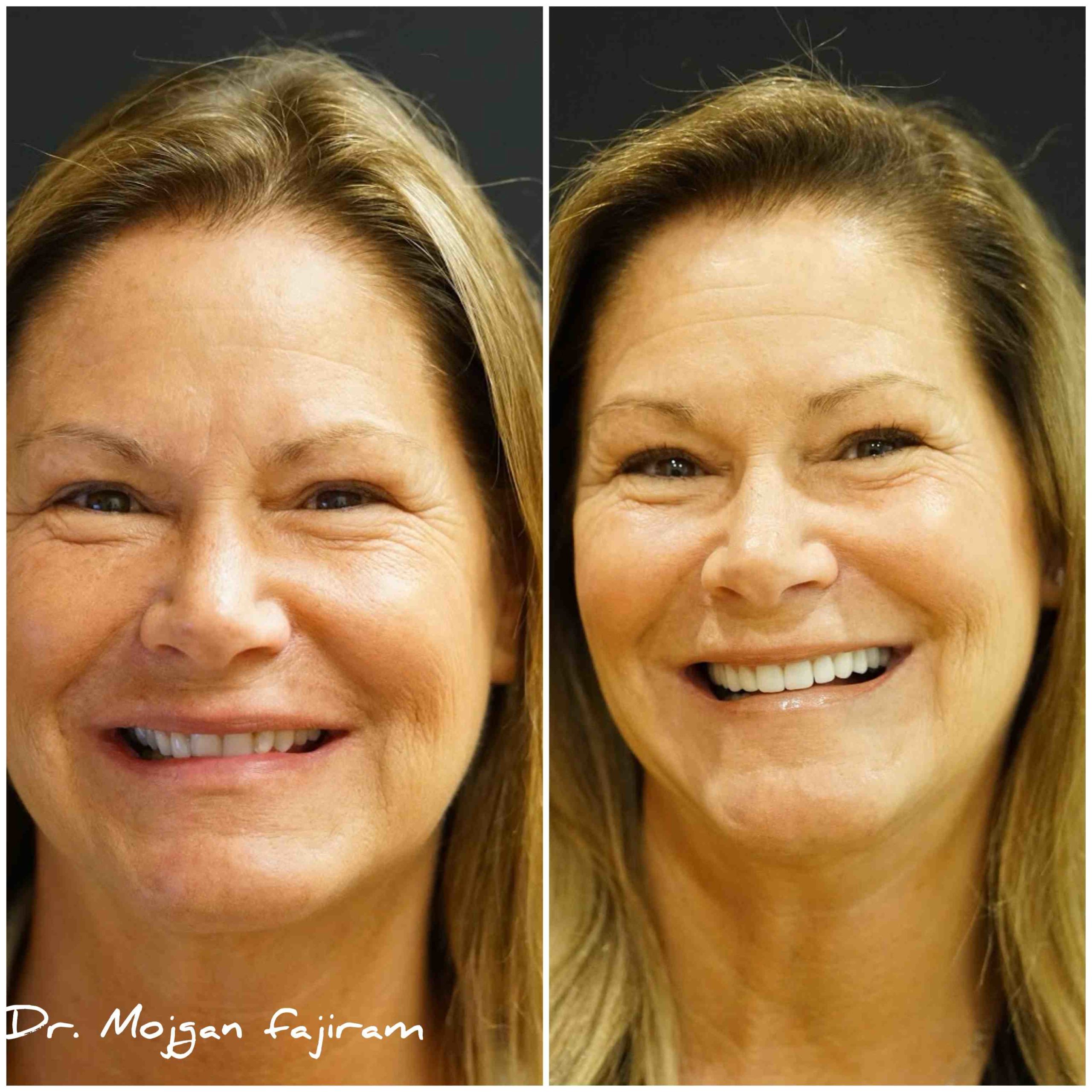 What is the best cosmetic dentistry?