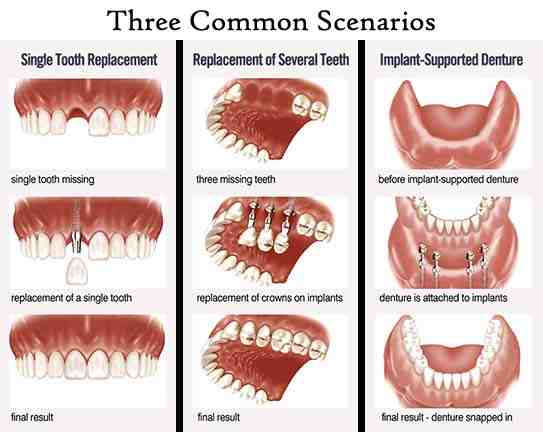 What is the best cosmetic dentistry?
