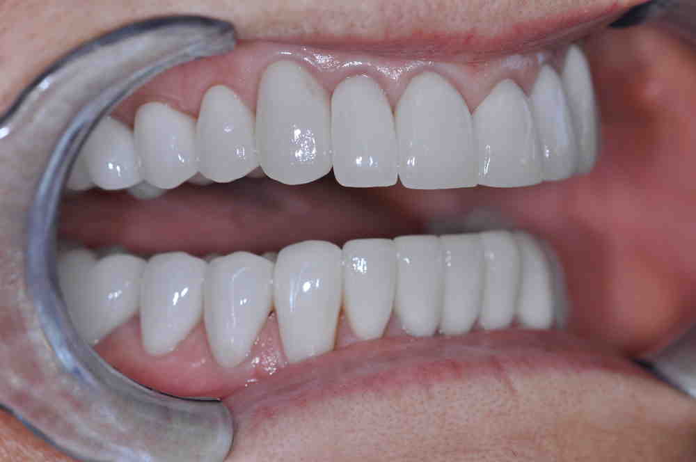 What is the difference between a cosmetic dentist and a regular dentist?