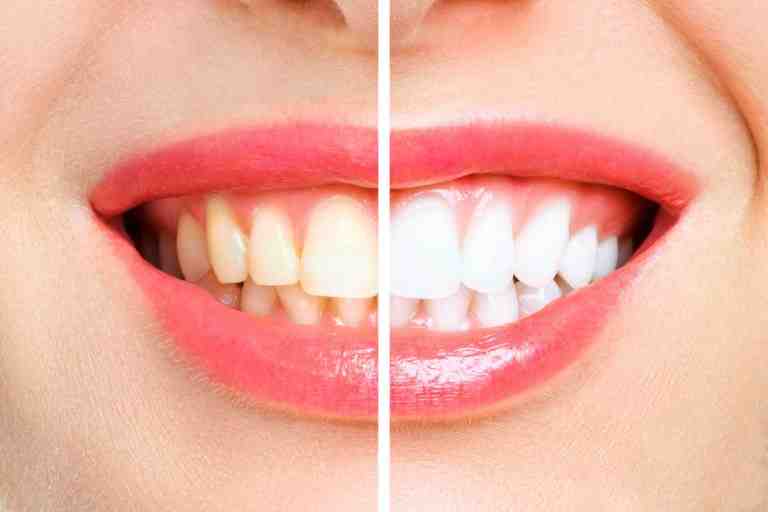 What is the difference between a general dentist and a cosmetic dentist?