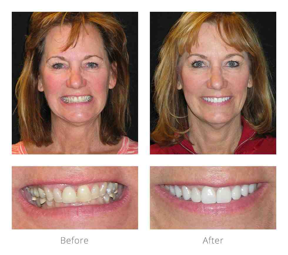 What is the difference between cosmetic dentistry and general dentistry?