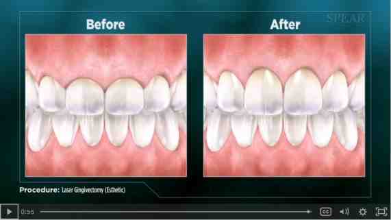 What is the difference between cosmetic dentistry and general dentistry?