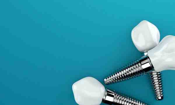 What is the downside of dental implants?