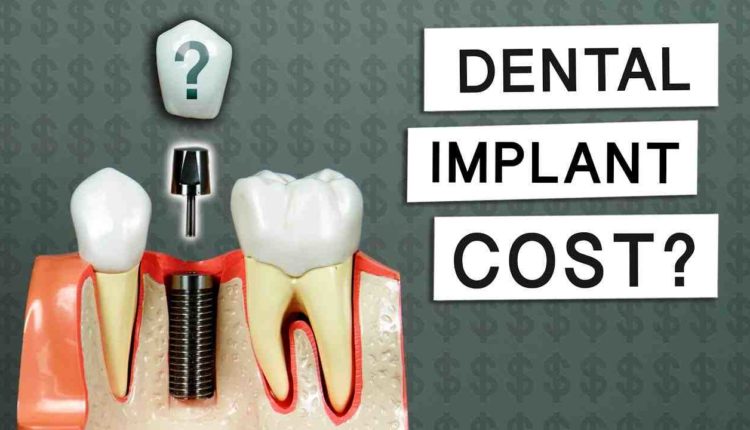 What is the price for dental implants