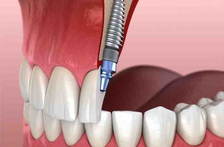 What type of dentist does cosmetic dentistry?