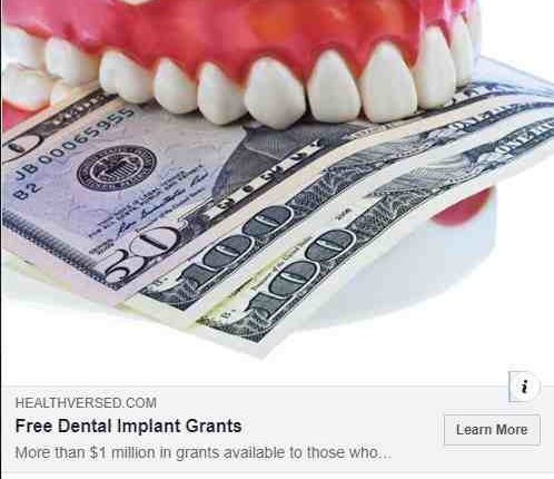 Are dental implants covered by medicare