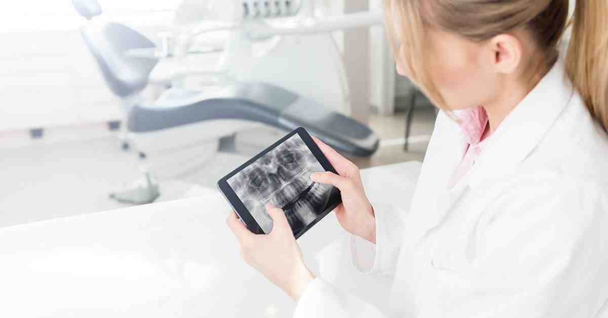Can a dental implant be done in one day?