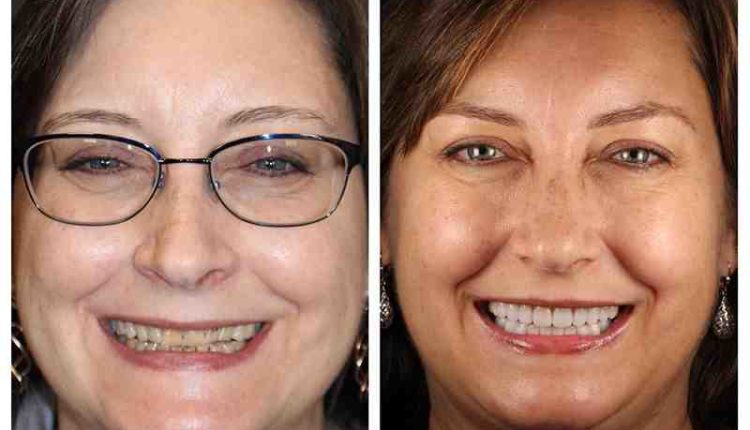 Cosmetic dentistry brand