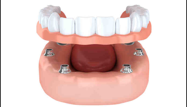 Cosmetic dentistry canadian county ok