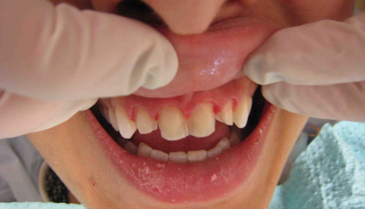 Cosmetic dentistry chinatown