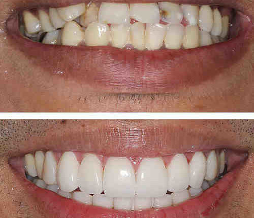 Cosmetic dentistry clackamas or