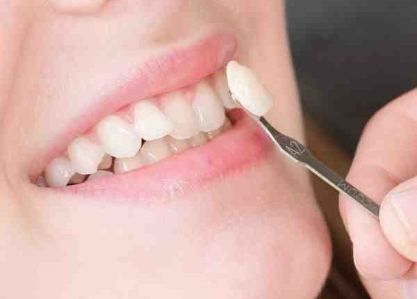 Cosmetic dentistry clarksville tn