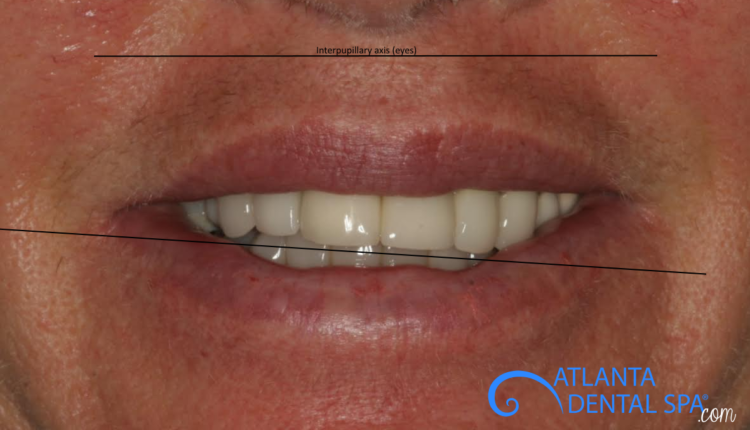 Cosmetic dentistry data