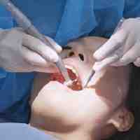 Do Most insurances cover dental implants?
