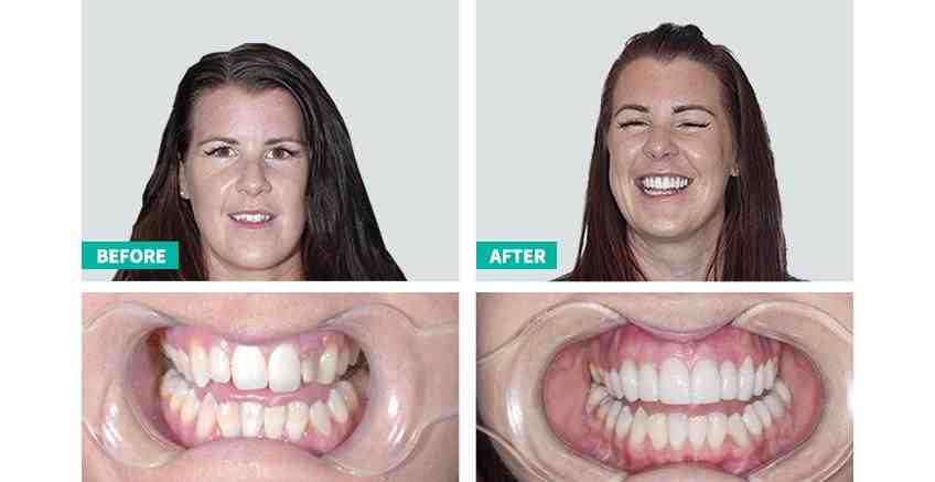 Do cosmetic dentists cost more?
