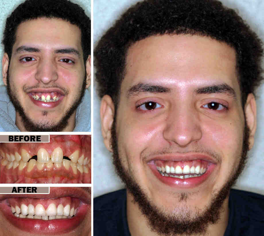 Cosmetic dentistry cons Dental News Network