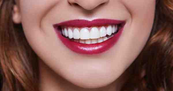 Do veneers affect lips?