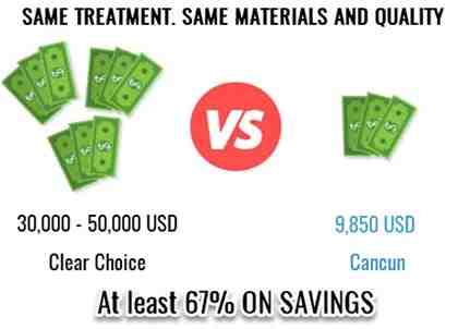 Does clear choice really do implants in one day?