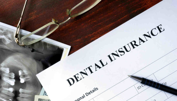 Does health insurance cover dental implants