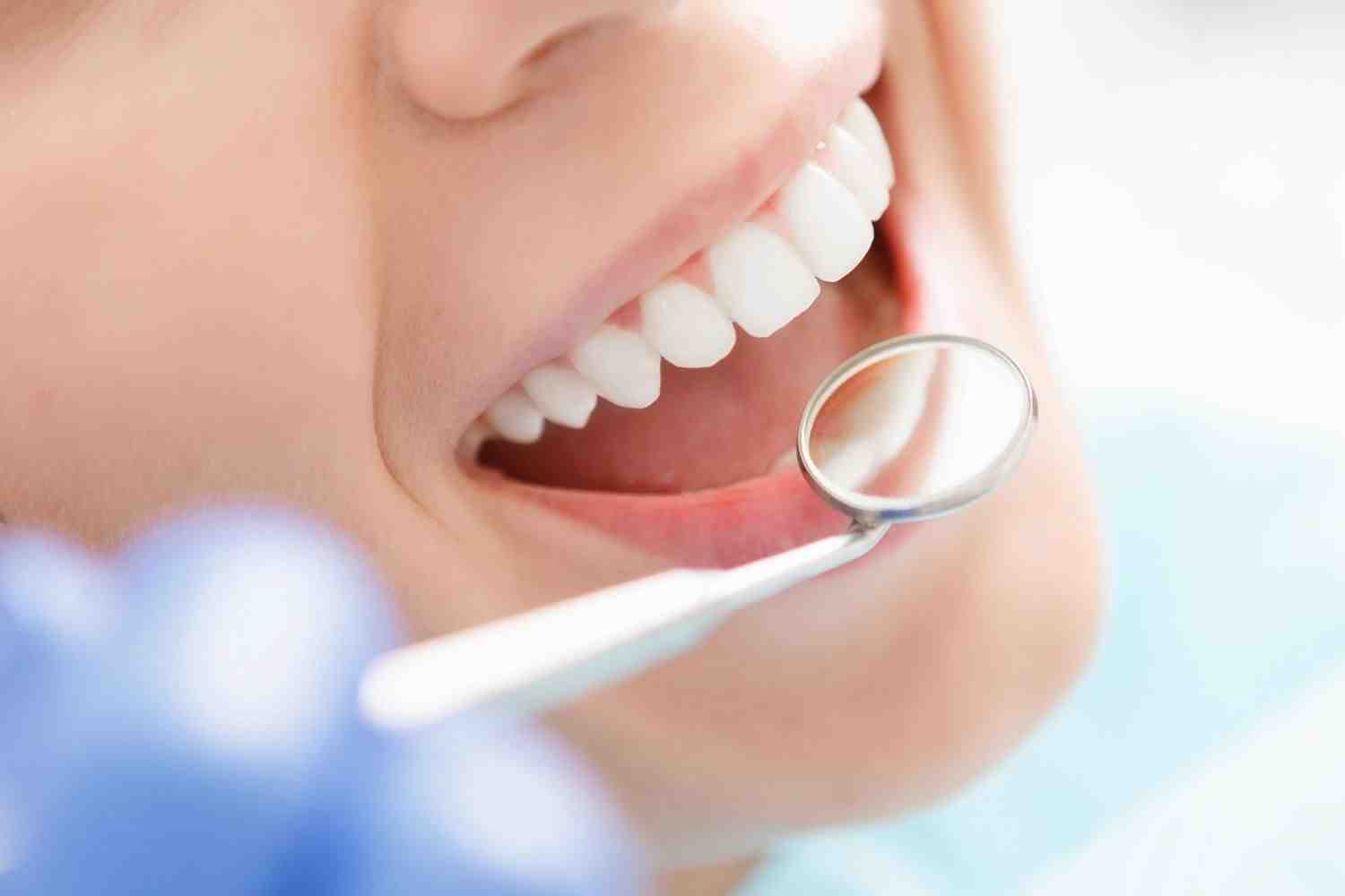 How Much Does A Full Dental Makeover Cost