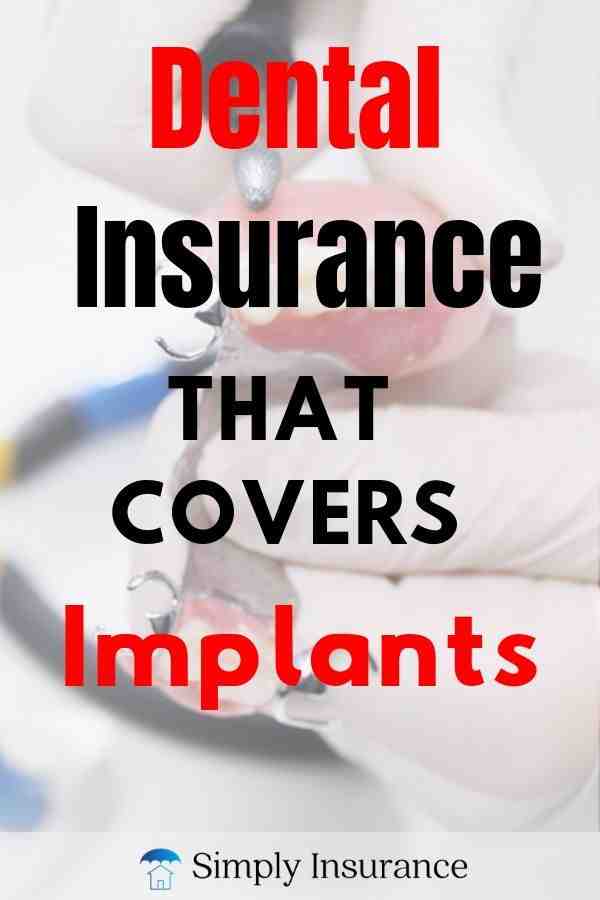Do any dental plans for seniors cover implants Dental News Network