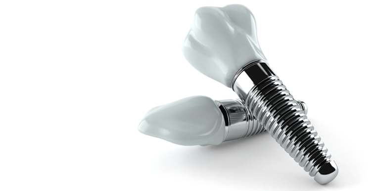 What is the best dental insurance for implants - Dental News Network