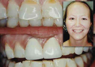 How do I choose a cosmetic dentist?