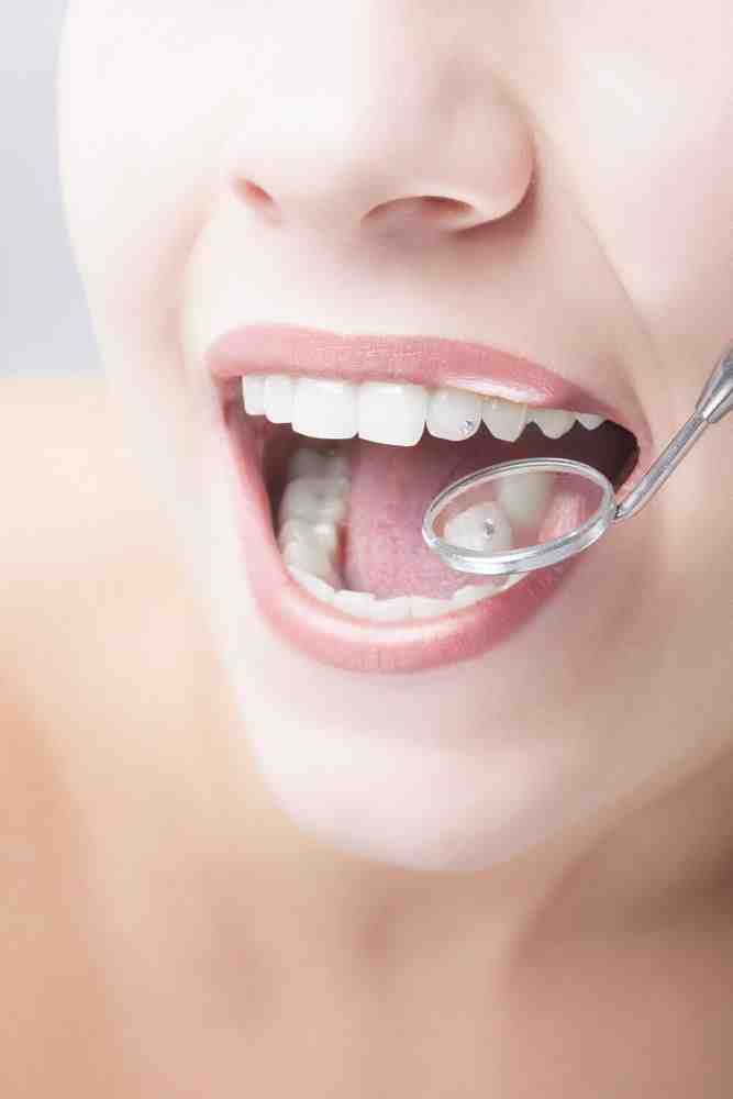 How do I choose a cosmetic dentist?