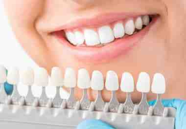 How long does cosmetic dentistry last?